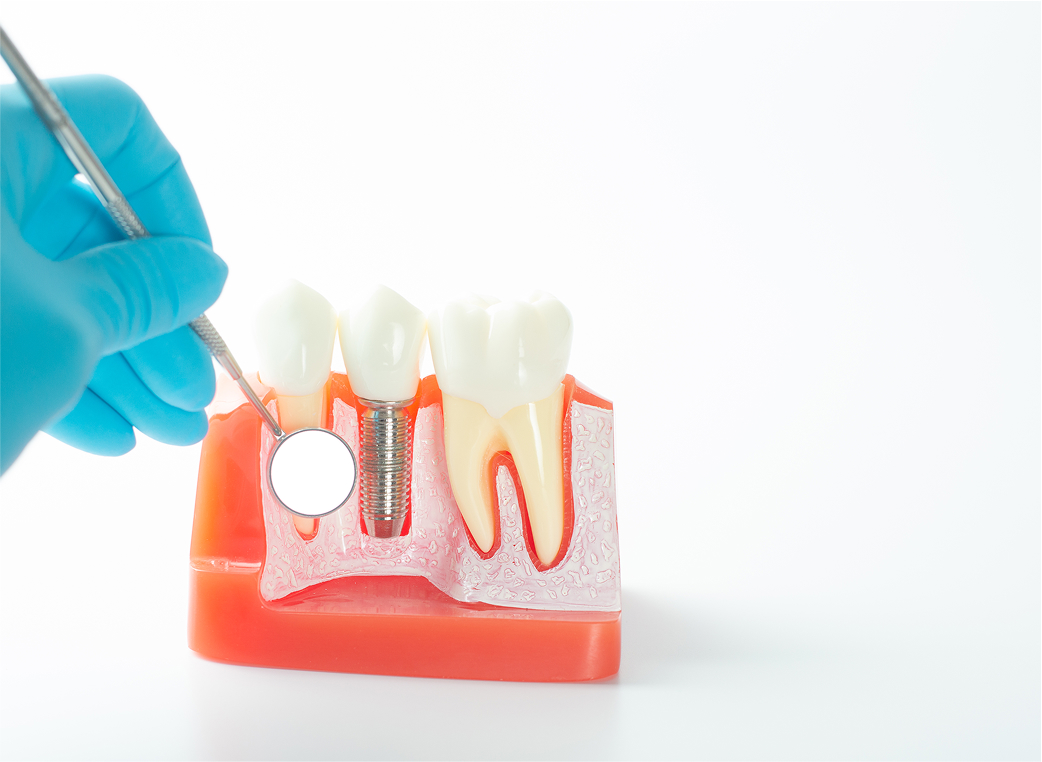 治療期間が長く、費用が高額